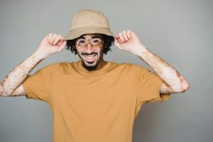 Lire la suite à propos de l’article Crème d’argan anti-psoriasis : Soulagez votre peau naturellement